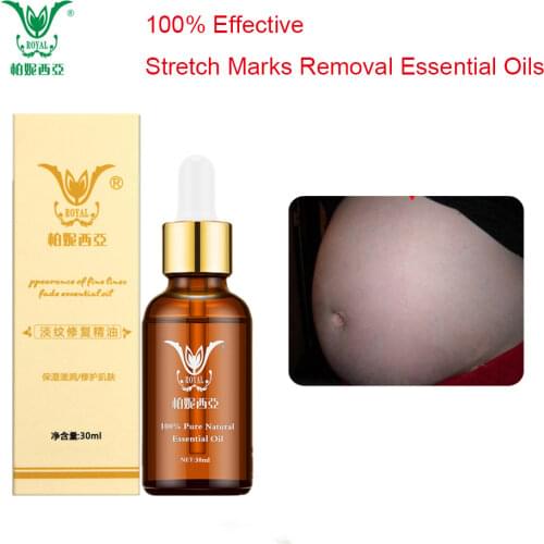 30ml Stretch Marks Removal Essential Oils Pure Natural Stretch Marks Remover Postpartum Anti-wrinkle Repair Cream free shipping