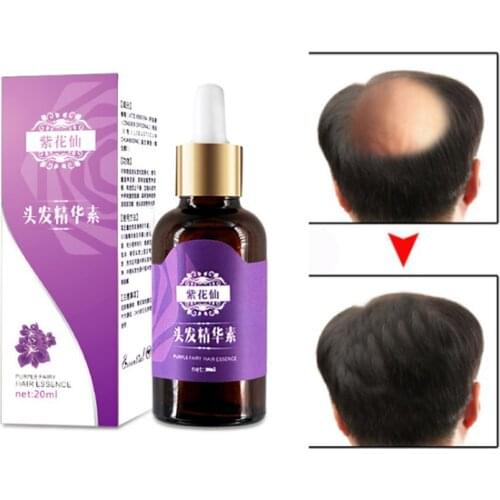 Hair Loss Products Natural With No Side Effects Grow Hair Faster Regrowth Hair Growth Products