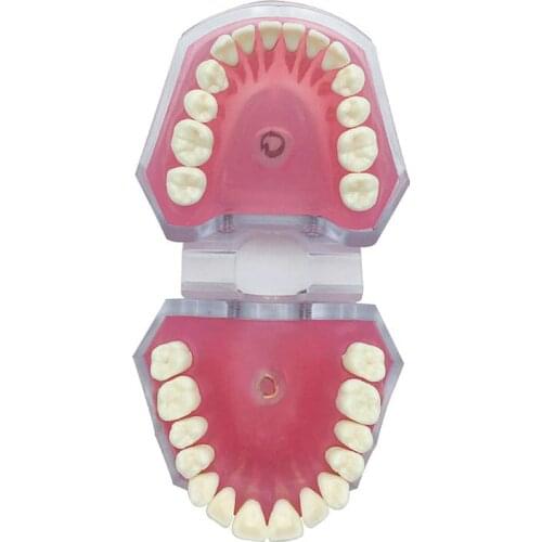 Dental Standard Model Removable Teeth Model Dentist Study Teach Model 7008