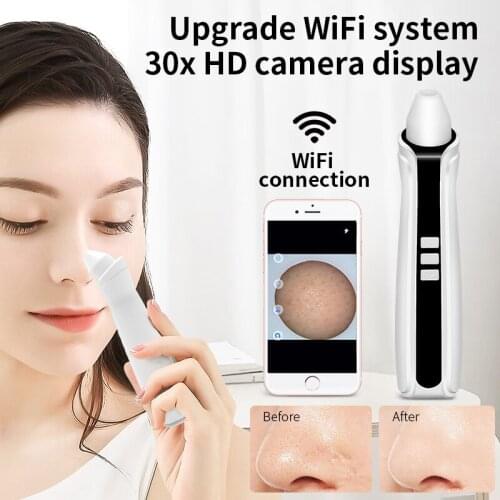 Family expenses With camera blackhead remover vacuum Regulation third gear electric Facial pore cleaner extraction tool Unisex