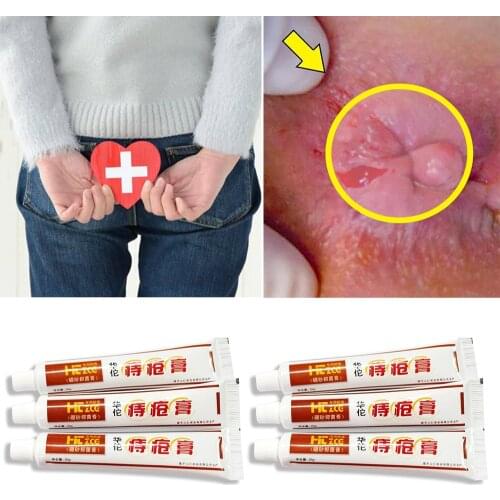 4 Pcs Hemorrhoids Cream Treating Acne Anal Fistula Pain Chinese Patch For Internal Hemorrhoids Piles External Anal Ointment