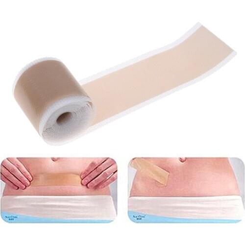 Efficient Surgery Scar Removal Silicone Gel Sheet Therapy Patch for Acne Trauma Burn Scar Skin Repair Scar Treatment 4x150cm