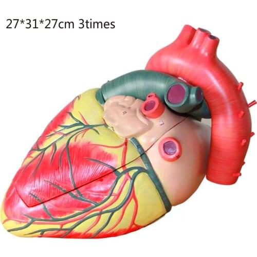 3 times 3 parts heart anatomy model Separable atrium and ventricle Cardiology Teaching display teaching aid model 27*31*27cm