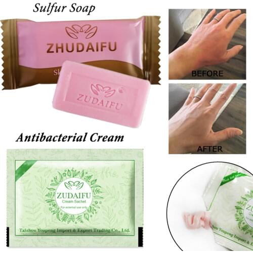 1PC zudaifu Sulfur Soap add 1PC zudaifu Psoriasis Cream Dermatitis Eczematoid Eczema Ointment Treatment Skin Psoriasis