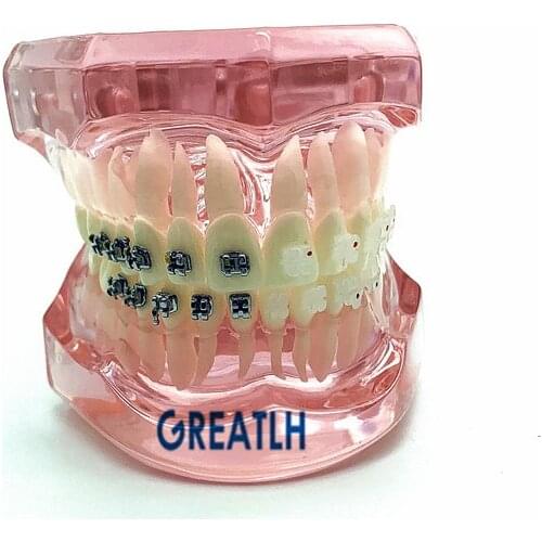 Dental Orthodontic Model with Metal and Ceramic Brackets 3003 Pink Dental school students Teeth Study Model
