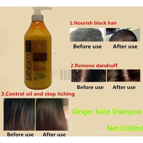 Ginger Shampoo Ginger Juice Men Women Anti Hair Loss Anti itching and Anti Dandruff Shampoo 1L