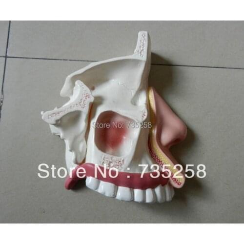 Nasal Cavity,The Nasal Anatomy Teaching Model