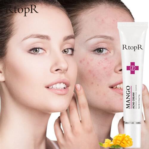 RtopR Mango Repair Acne Cream Whitening Blackhead Shrink Pores Anti-acne Moisturizing Scar Facial Skin Care