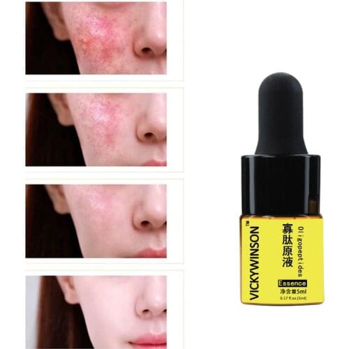 Oligopeptides essence 5ml Stock Solution Whitening Essence Shrink Pores Fade Acne Marks To Acne Essence Skin Care