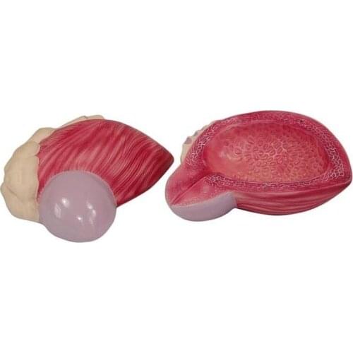 Bladder magnification model