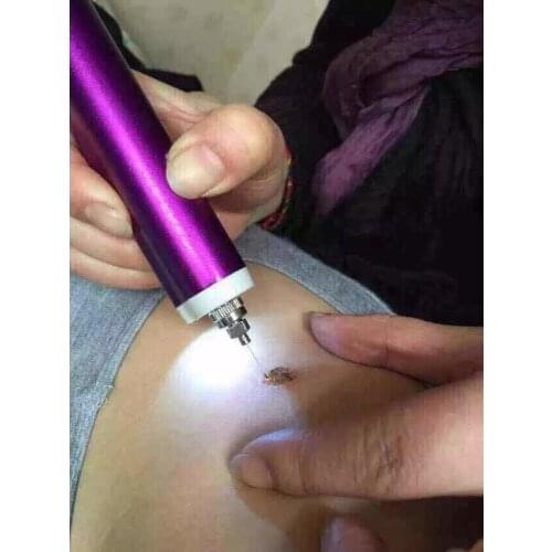 Fast Shipping Micro Plasma Freckle Removal Pen Beauty Mole Freckle Removal Machine Sweep Spot Pen