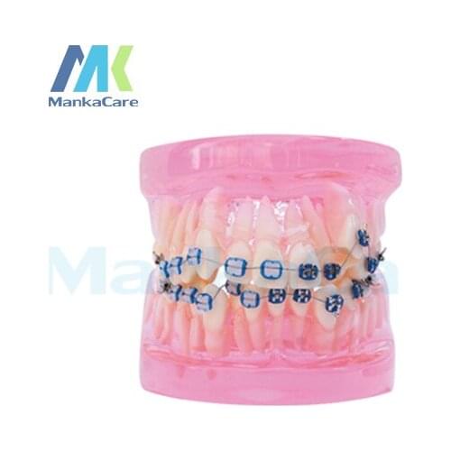 Manka Care - 28 pcs Tooth, half metal&half ceramic bracket Oral Model Teeth Tooth Model