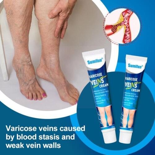 ​20g Varicose Vein Cream Anti-bacterial Effective Red Repair Leg Ointment Streak Vasculitis Phlebitis blood Treatment Raise K8N8