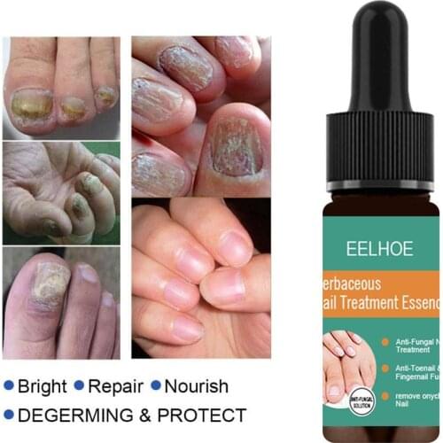 10ml/30ml Onychomycosis Liquid Hand And Foot Onychomycosis Repair Care Antibacterial And Treatments Thickening Nail V3P9