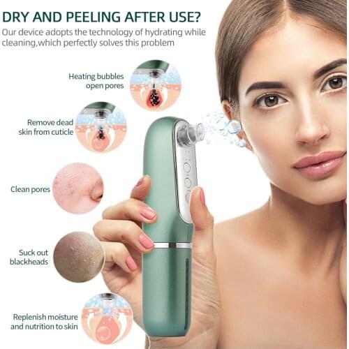 3-IN-1 Heating Microbubble Blackhead Remover Hot Nano Bubble Open Pore Water Cycle Vacuum Suction Deep Cleaning Face T Zone Nose