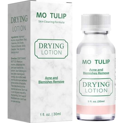 30ml Face Lotion Acne Treatment Serum Face Facial Essence Scar Removal Cream Whitening Repair Pimple Remover Skin Care