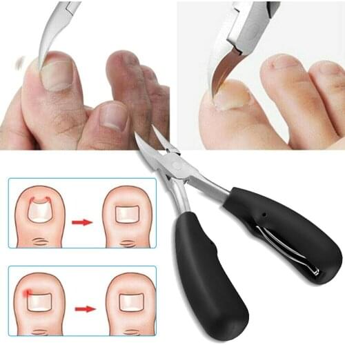 Toe Nail Clippers Dead Skin Dirt Remover Ingrown Toenail Cutters Anti-Splash Paronychia Correction Pedicure Tool Nail Supplies
