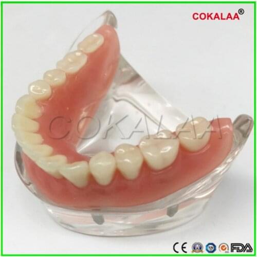 Good quality 4 nails Mandibular model dental lower jaw implant model dentures teeth model for dentists learning