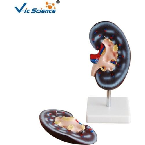Medical Science PVC Teaching Human Anatomy Kidney Model for Students