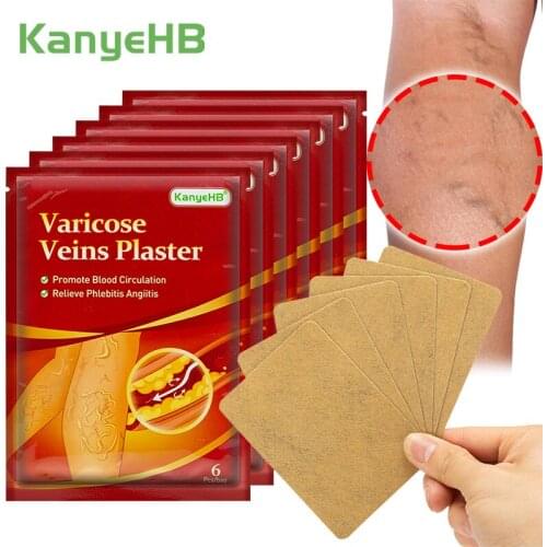 36pcs/6bag New Varicose Veins Treatment Plaster Vasculitis Phlebitis Chinese Medicine Medical Plaster Angiitis Removal PatchA597