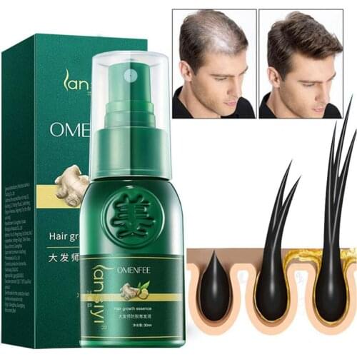 QYF Hair Loss Remedies