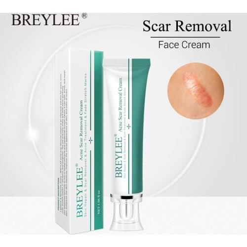 Acne Scar Removal Cream 30g Face Cream Skin Repair Skin Care Scar Acne Treatment Remove Stretch Marks Whitening Cream
