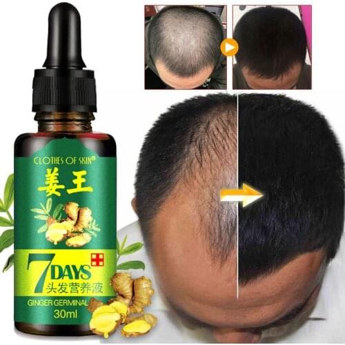 Ginger Hair Growth Oil Essence Hairdressing Hairs Mask Serum Dry and Damaged Hairs Deeply Nutrition Care 30ml 1Pcs