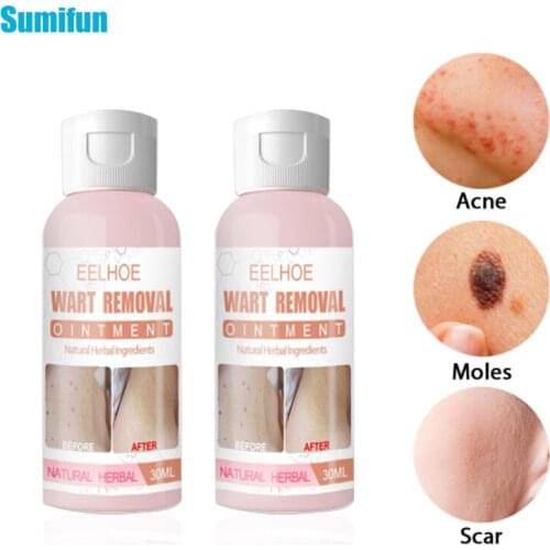 30ml Warts Removal Ointment Wart Treatment Cream Skin Tag Remover Herbal Extract Plaster Antibacterial Warts Ointment Skin Care