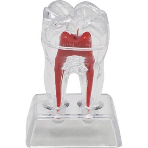 Teeth Model Teaching Teeth Tool Dental Adult Typodont For Medical Science Transparent Removable Dental Teeth Model Implant Model