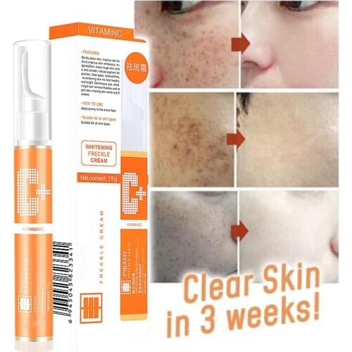 Instant Blemish Removal Gel Vitamin C Whitening Anti Freckle Cream Anti-wrinkle essence Remove Freckle Pigmented Melanin Spots