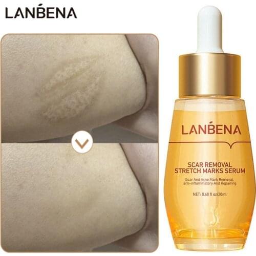 LANBENA Scar Removal Serum Remove Acne Scar Improve Stretch Mark Burn Scar Pockmark Pigmentation Corrector Repair Scar Treatment