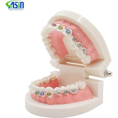 1pc Dental Orthodontic Treatment Model With Ortho Metal Ceramic Bracket Arch Wire Buccal Tube Ligature Ties Dental Tools