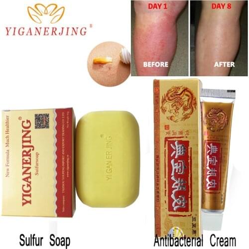 1PC yiganerjing Sulfur Soap add 1PC yiganerjing Anti Bacteria Eczema Psoriasis Cream Body Patches Wholesale