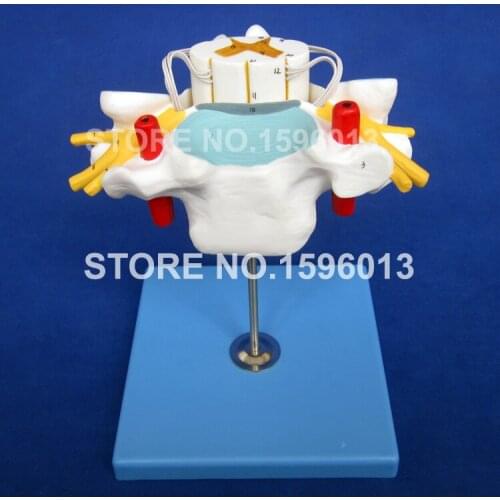 HOT Anatomical Cervical Spine Model,Cervical Vertebra with Spinal Cord and Nerves Model