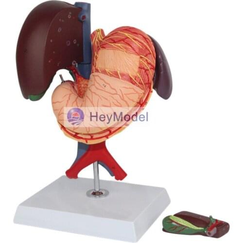 HeyModel Hepatopancreas duodenum model of gastric structure