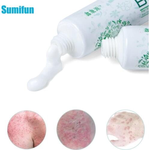 1Pcs 20G Anti-Itch Psoriasis Cream Bacteriostasis Eczema Dermatitis Anti-Inflammatory Pruritus Antipruritic Eczematoid Oinitment