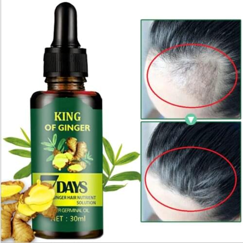 Hot Skin clothes ginger King hair nutrient solution ginger King ginger hair solution in stock