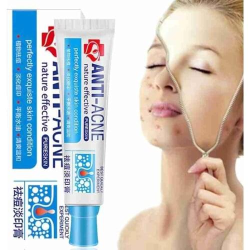 30g Acne Scars Cream Acne Treatment Face Care Anti Acne Removal Gel Whitening Moisturizing Cream Makeup Shrink Pore Cream