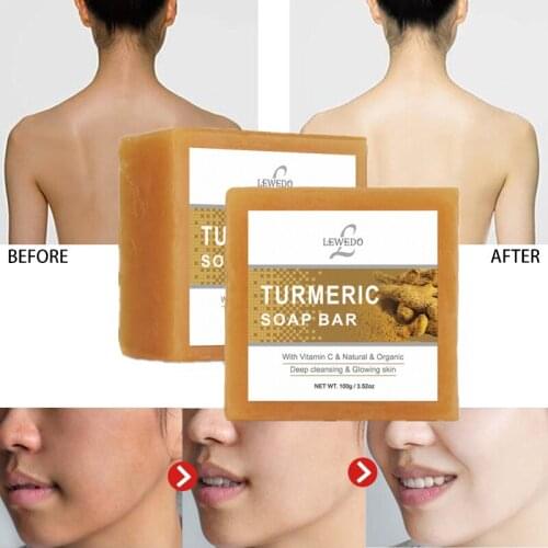 Natural Turmeric Handmade Soap Tea Tree Essential Oil Moisturizing Whitening Cleansing Soap Skin Care Oil-Control Shower Soap