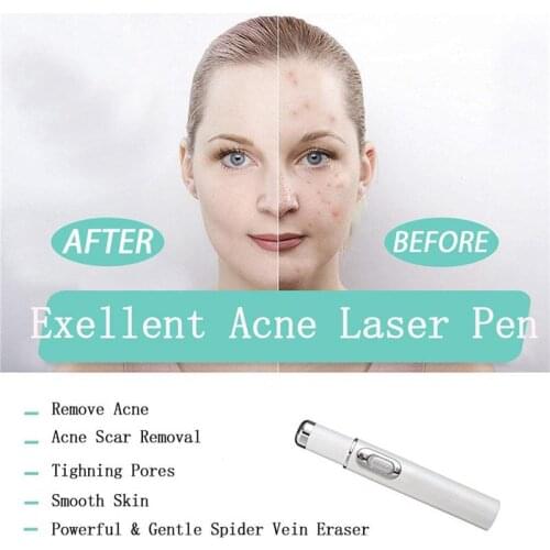 Wholesale Blue Light Therapy Varicose Veins Treatment Laser Pen Soft Scar Wrinkle Removal Treatment Acne Laser Massage Relax 1pc