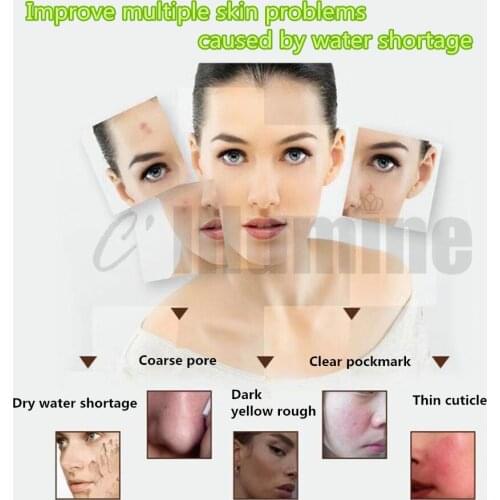 Nicotinamide Skin Lotion 100ml Moisturizing Replenishing Water Improve Dark Yellow Shrink age Pores OEM Cosmetics