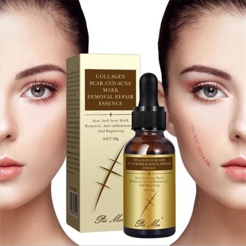 30g Collagen Essence Scar Repair Skin Essential Oil Natural Pure Remove Ance Burn Strentch Marks Scar Removal