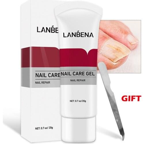 Nail Fungus Removal Cream Onychomycosis Fungal Nail Treatment Paronychia Anti Infection Feet Toe Fungal Nail Care Gel Hot Gift