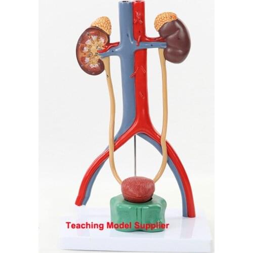 Human Anatomy Bladder Catheterization Renal Urinary System Model Kidney Model Arteriovenous Model Medical Teaching