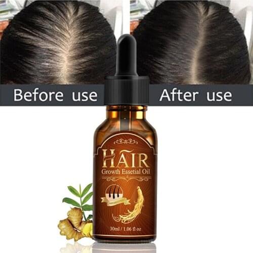 Hair Growth Essential Oils Essential Pure Natural Extract Beauty Dense Hair Care Hair Loss Liquid Health Care Hair Growth Serum