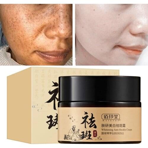 Anti-Freckle Cream Moisturizing Nourish Repair Whitening Anti-Aging Antioxidant Inhibit Melanin Lighten Spots Face Skin Care 50g