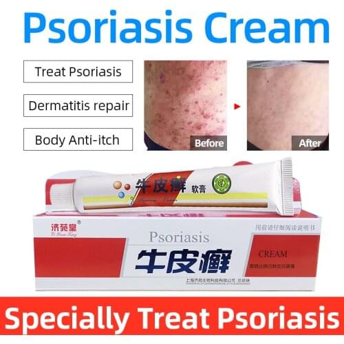 Psoriasis Ointment Eczema Pruritus Anti-allergy Itching Repair Body Massage Chinese herbal Medicine Eczema Cream