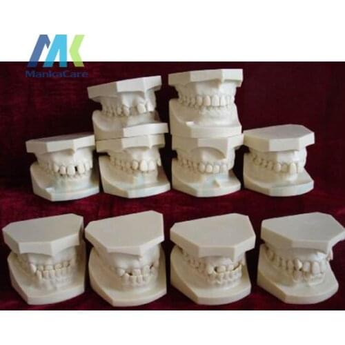Models with designed according to Dr.Angel`s classification of malocclusions. Aset of 10 models Oral Model Teeth Tooth Model