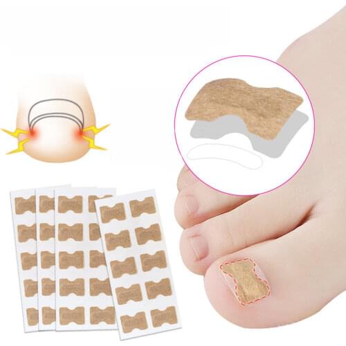 5pcs Glue Free Ingrown Toenail Patch Set Toenail Correction Pedicure Tools Inlay Nail Corrector Stickers Nail Foot Care