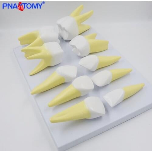Enlarged Deciduous Teeth Model Incisors Canines Molars Anatomical Model Dental Tool Educational Equipment Medical Model PNT-0535